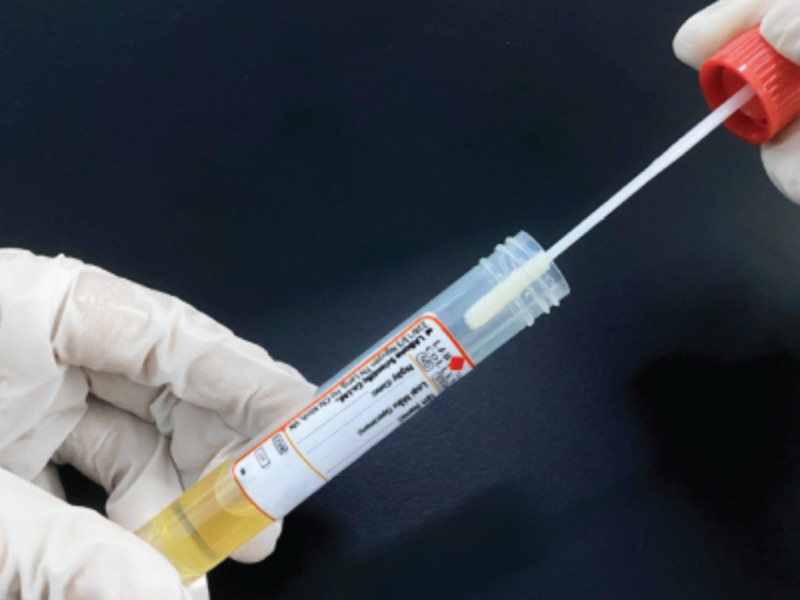 Lấy mẫu bề mặt (Swabbing)