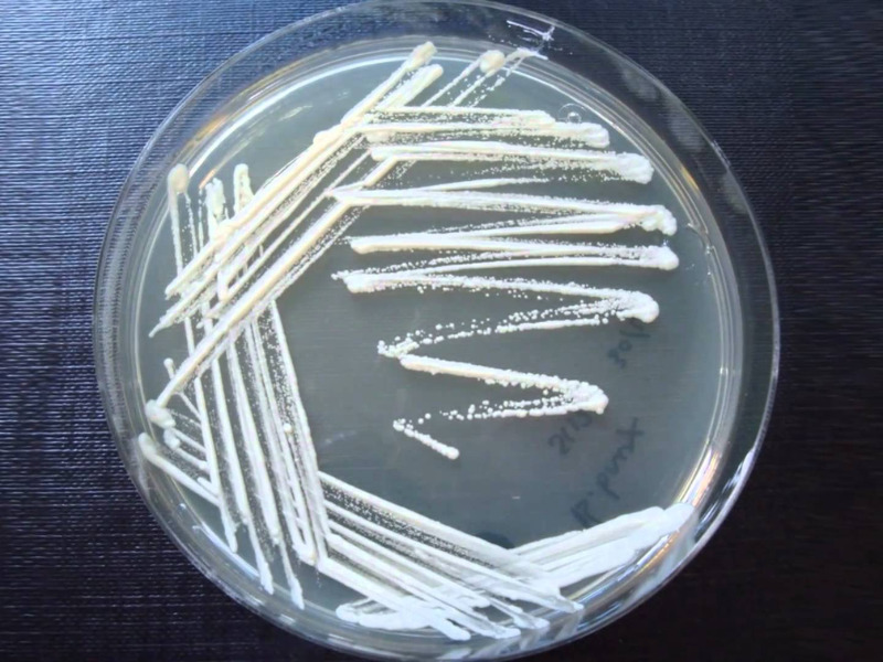 Lấy mẫu bề mặt (Đĩa RODAC)